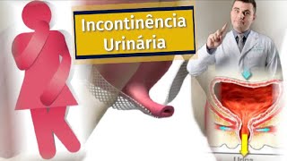 TUDO sobre Incontinência Urinária Perda de Urina [upl. by Enuahs238]