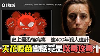 Know more SmallpoxVariola Virus了解更多天花病毒 廣東話版本 [upl. by Nileek]