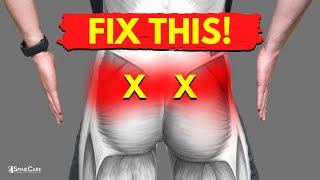 How to Fix SI Joint Pain in 30 SECONDS [upl. by Reube]