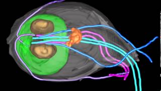 A Giardia trophozoite reconstructed by 3View Gatan Inc [upl. by Rosel63]