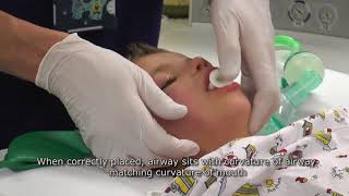 Paediatric Anaesthetics Chapter 1  Mask anaesthesia after iv induction [upl. by Arri]