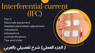 الجزء العملي الخاص ب Interferential current IFCIFT [upl. by Avitzur502]