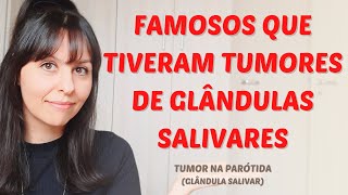 Famosos que tiveram tumores em glÃ¢ndulas salivares tumor na parÃ³tida [upl. by Nospmoht]