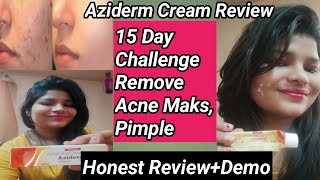 Azederm Cream ReviewAziderm Cream Side EffectiveAziderm 20 cream एज़िडेर्म् क्रीम [upl. by Ecnarrot898]