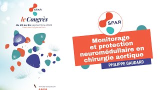 Monitorage et protection neuromédullaire en chirurgie aortique  PGAUDARD  SFAR [upl. by Mezoff774]