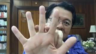 Gout versus OsteoArthritis Iba ang 2 sakit  ni Doc Willie Ong 489 [upl. by Senalda]