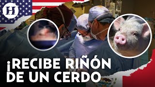 ¡Histórico trasplante Colocan exitosamente riñón de cerdo modificado en un humano por primera vez [upl. by Edsel418]