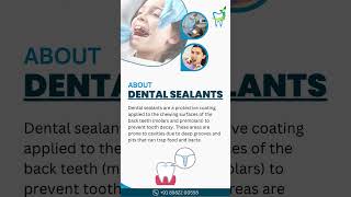 Dental sealant dentalimplants dentalmagic hospital smiledental [upl. by Newbold]