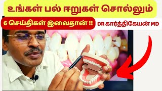 பல் ஈறு பிரச்சினைகளூம் உடல் பிரச்சினைகளும்  dr karthikeyan dental tamil [upl. by Pogah415]