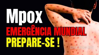 🆘 Mpox Emergência sanitária Global 🤧 [upl. by Uase]