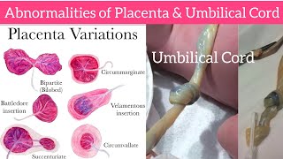 Abnormality of Placenta amp Umbilical Cord  Abnormalities of Placenta  Abnormalities Umbilical Cord [upl. by Rollo95]