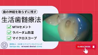 歯の神経を取らずに残す 【愛知県刈谷市の歯医者】 生活歯髄療法 ダイレクトボンディング MTAセメント ラバーダム防湿 マイクロスコープ Vital Pulp Therapy Kariya city [upl. by Eak400]