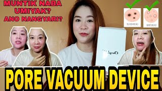 PORE VACUUM DEVICE HOW TO USE IT [upl. by Docila]