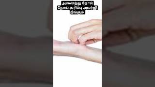 அனைத்து தோல் நோய் அரிப்பு அலர்ஜி நீங்கும் shorts viral trending skin [upl. by Surad642]