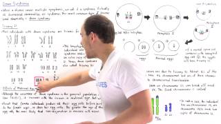 Down Syndrome Trisomy 21 and Translocation [upl. by Nowell9]