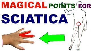 Sujok Therapy For SciaticaSujok Points For SciaticaSujok Acupressure Points For Sciatica [upl. by Wenda]