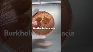 Burkholderia cepacia trên thạch MC BurkholderiaCepacia ViKhuanNguyHiem MacConkey YHoc SucKhoe [upl. by Daye]