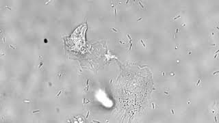 Phagocytosis of P aeruginosa by iPSCderived neutrophils [upl. by Savell479]