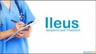 Ileus Symptoms and Treatment [upl. by Ttirrej]