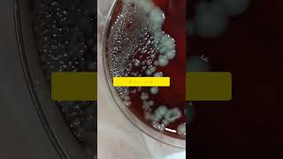 Acinetobacter la Bacteria más peligrosa ⚠️ [upl. by Carlynne]