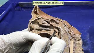 Pharynx I  Internal features [upl. by Templa947]