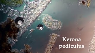 Kerona pediculus [upl. by Downall227]