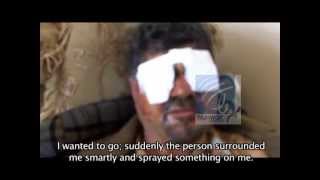 Mamoon And Suspect In Attack Interview Afghanistan [upl. by Aridan]