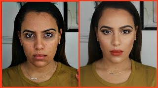 Como Cubrir Acne Manchas Ojeras con CORRECTORES DE COLORES  MUY FACIL 2017 [upl. by Cuda]