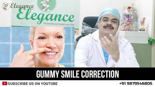 Gummy Smile Correction Botox  Filler Treatment Elegance Clinic Surat Gujarat Mumbai Maharashtra [upl. by Ahtenak]