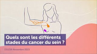 Quels sont les différents stades du cancer du sein [upl. by Irec]