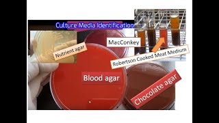 Culture media the simplest way of identification  Blood MacConkey  Chocolate RCM Nurient agar [upl. by Sert301]