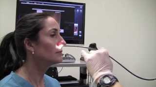 Esophagoscopy Without Sedation TransNasal Esophagoscopy Esophagus Exam Endoscopy [upl. by Lavoie]