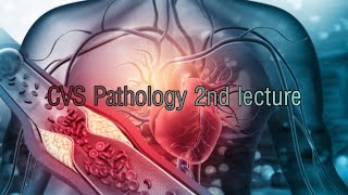 Rheumatic Fever and Infective endocarditis lecture [upl. by Finny662]