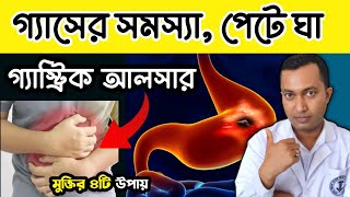 গ্যাসের সমস্যা পেটে জ্বালাপোড়া পেপটিক আলসারের কারণ লক্ষণ এবং চিকিৎসা Gastric Ulcer Home remedies [upl. by Akcimat]