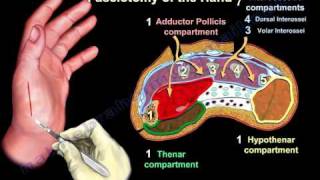 Compartment Syndrome Of The Hand amp Finger  Everything You Need To Know  Dr Nabil Ebraheim [upl. by Nymzaj119]