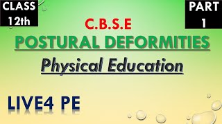 Postural Deformities  Class 12  Physical Education LIVE4PE [upl. by Madison949]