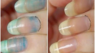 How to remove serious nail stains [upl. by Lamej]