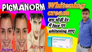 whitening cream pigmanorm इस्तेमल कैसे करे जानिए। [upl. by Buseck218]