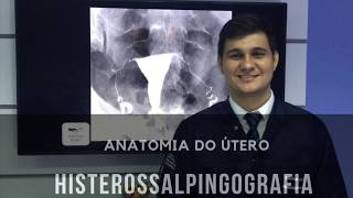 Anatomia do Útero  Histerossalpingografia  Radiologia Prática [upl. by Tormoria235]