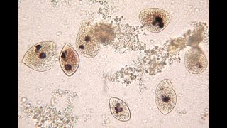 Balantidium coli Presence in Human Urine Sample A Mere Coincidence or More [upl. by Namra]