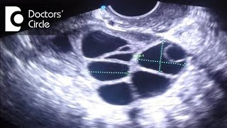 What do follicle size change in follicular study scan signify  Dr Teena S Thomas [upl. by Hsihsa]