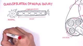 Neurology  Nerve Damage and Regeneration [upl. by Annawal]