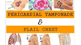 PERICARDIAL TAMPONADE amp FLAIL CHEST [upl. by Rockey838]