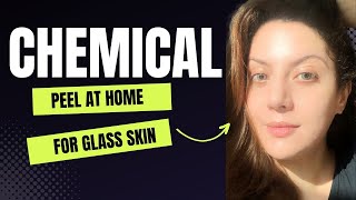 How to do a Chemical peel at home I How to use peeling solution the ordinary  Nipun Kapur [upl. by Odell656]