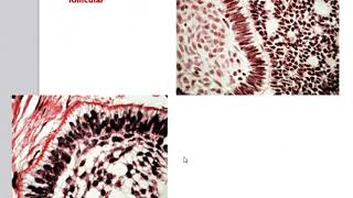 Odontogenic Tumors [upl. by Tamas]