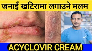 जनाई खटिरा र माकुराले छुंदा आउने खटिरामा लगाउने मलम ।ACYCLOVIR cream uses in Nepalihealth [upl. by Venezia]