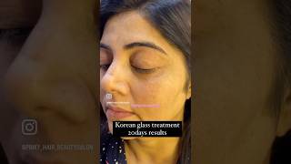 Korean glass treatment 20days resultsshortsytshortsytyoutubeshortsyoutubepinkyhairbeautysalon [upl. by Ainslie]