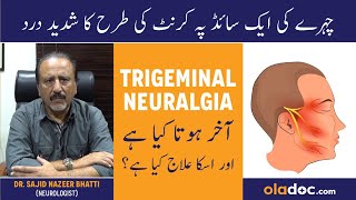 Trigeminal Neuralgia Symptoms Treatment  Chehre Ke Side Pe Dard Ka Ilaj  Facial Pain Releif [upl. by Merriott]