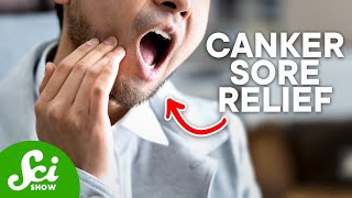 How to Get Rid of Canker Sores According to Science [upl. by Aggarwal972]