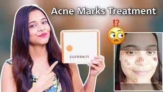 My Personal Experience with CURESKIN App amp Review  How to use Cureskin App  SuperBeautyDezires [upl. by Aikemahs349]